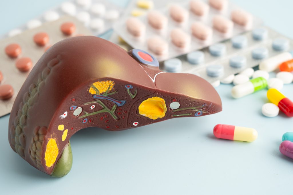 liver model with pill drug treatment, cirrhosis, liver cancer, f